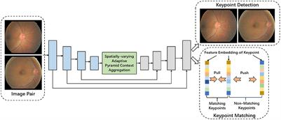 Reliable and stable fundus image registration based on brain-inspired spatially-varying adaptive pyramid context aggregation network